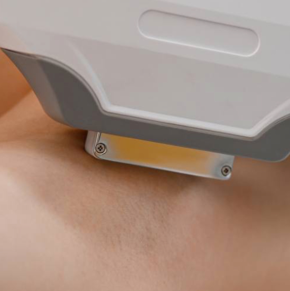 СЕТ: глубокое бикини + подмышечные впадины