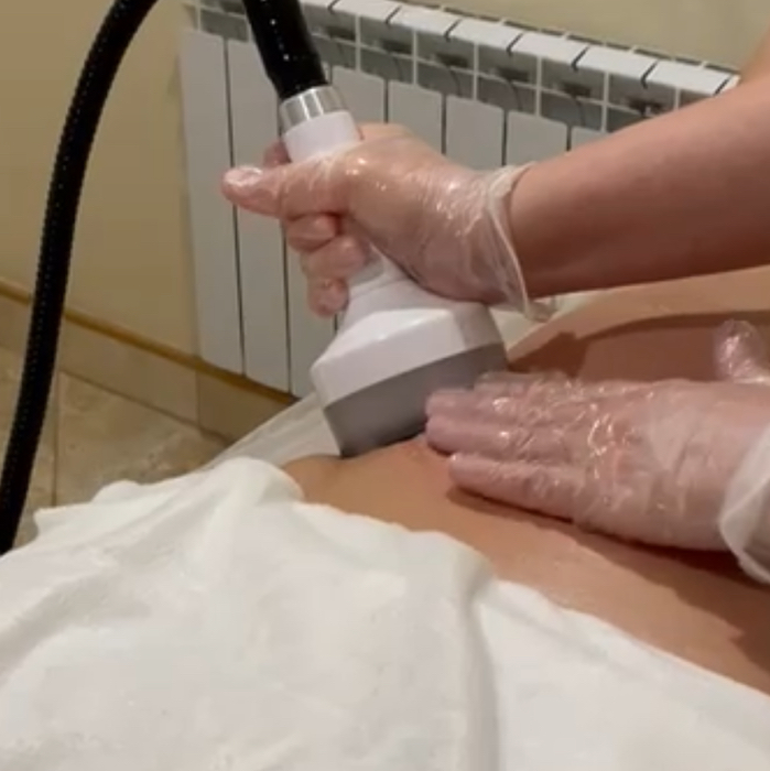 Вакуумный массаж (все тело)