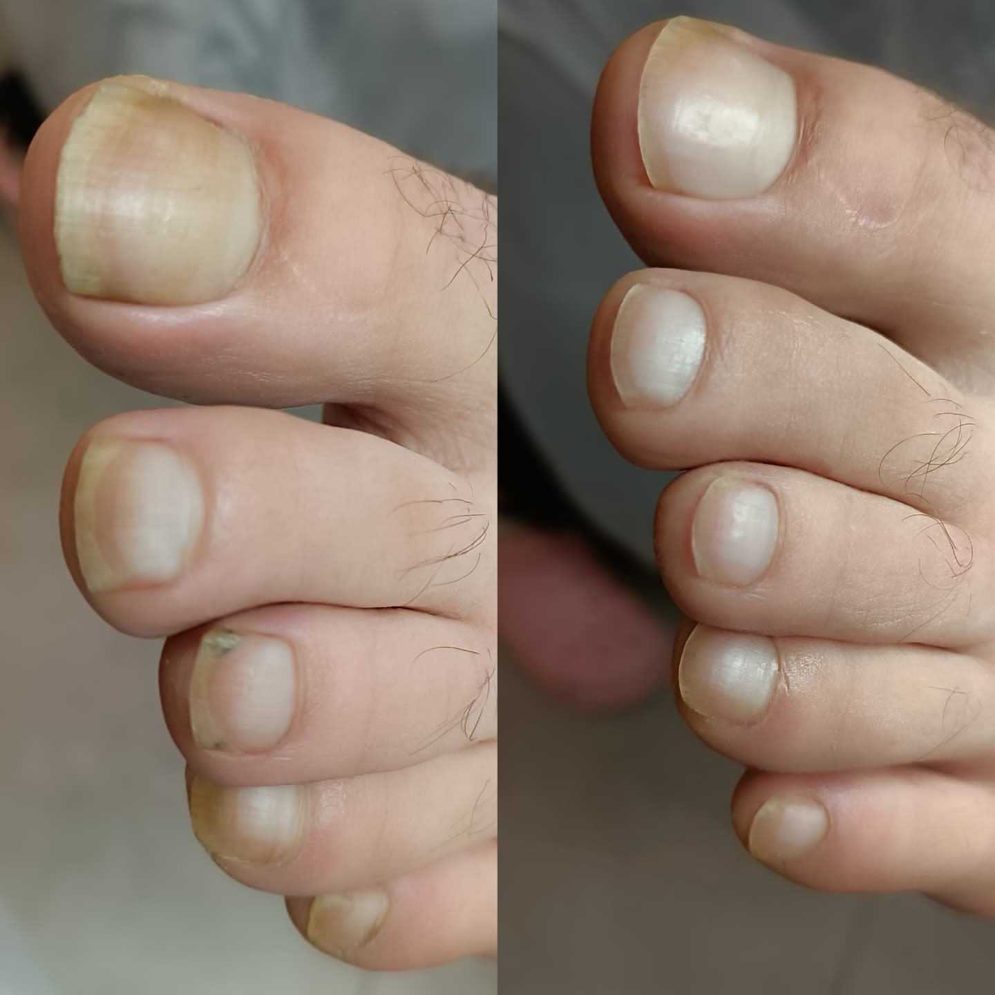 Педикюр мужской