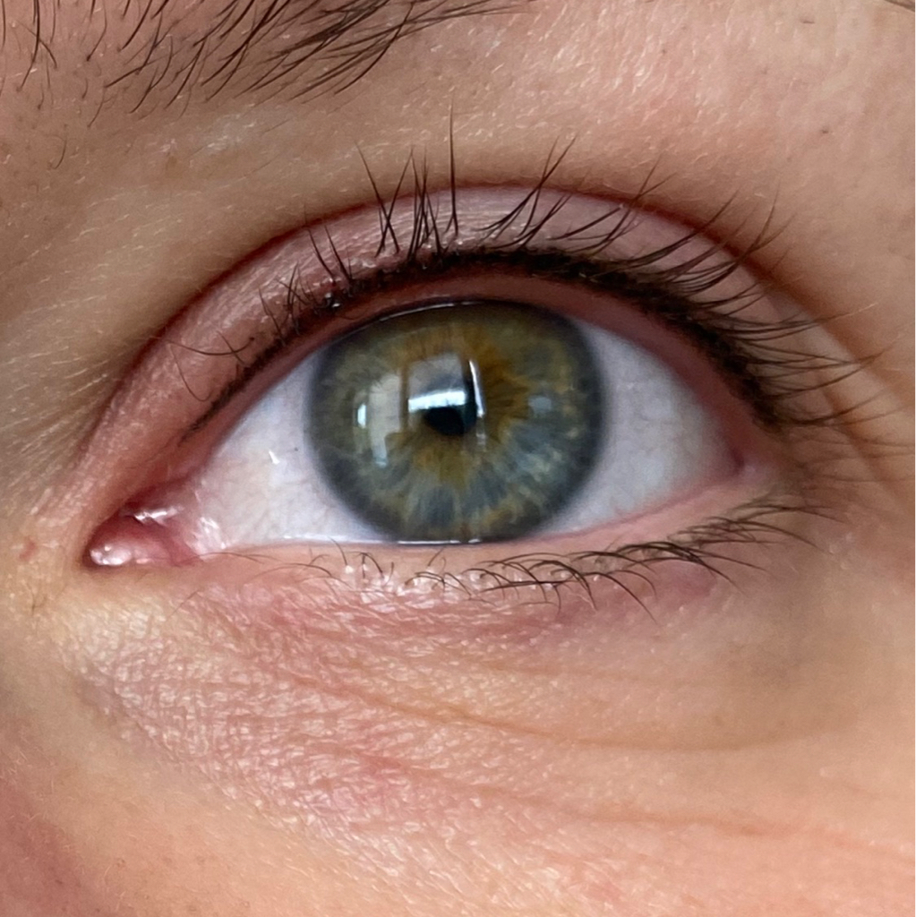 Перманент межреснички