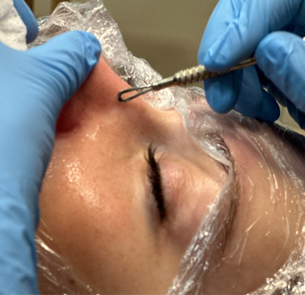 Чистка лица