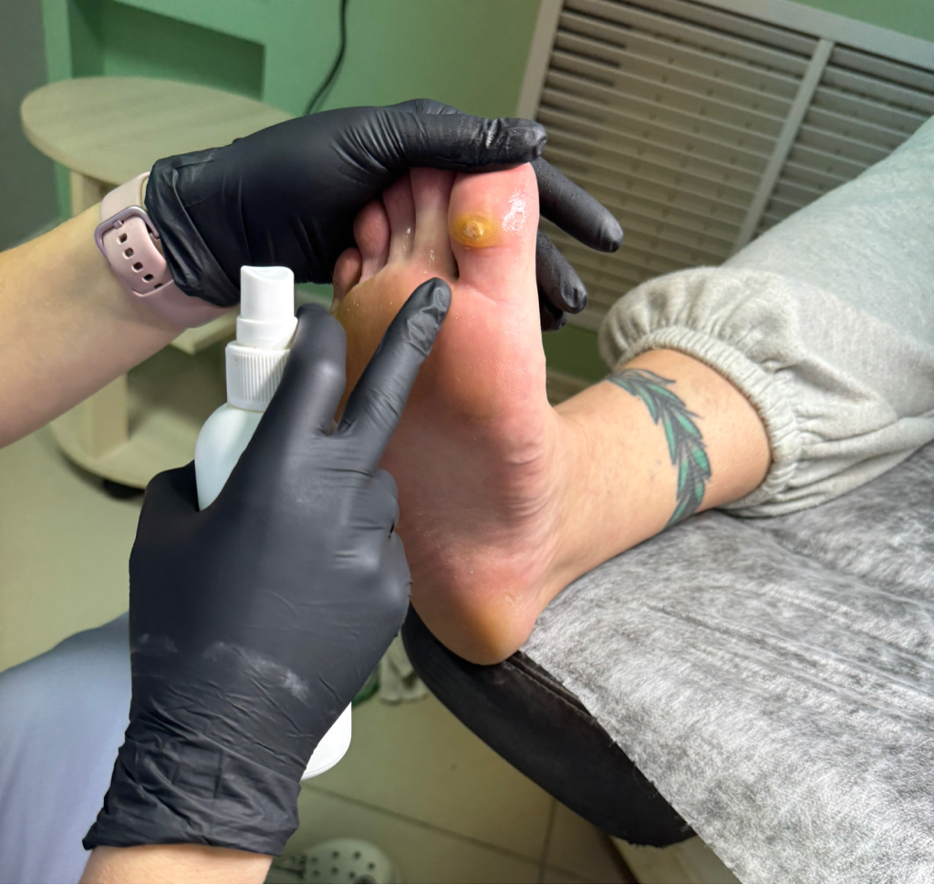 Консультация подолога