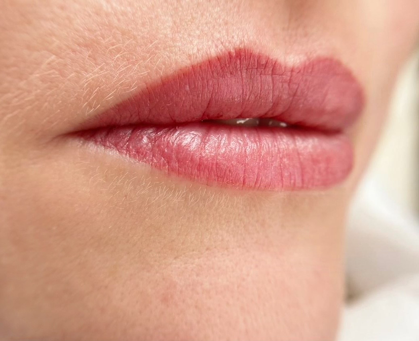 Коррекция перманента губ