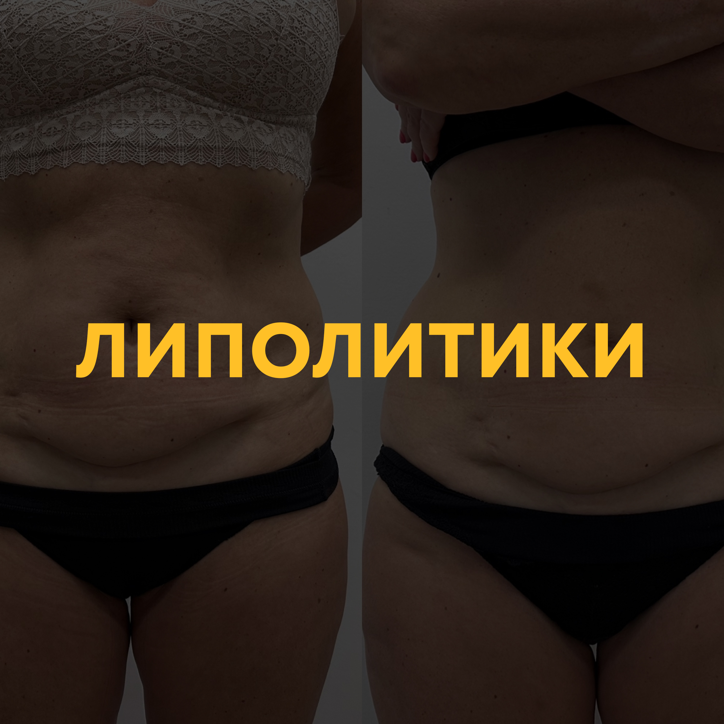 Липолитики