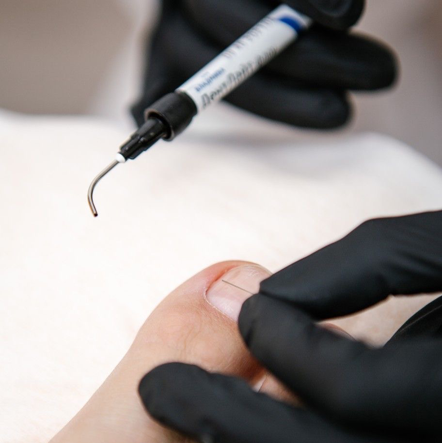 Установка титановой нити