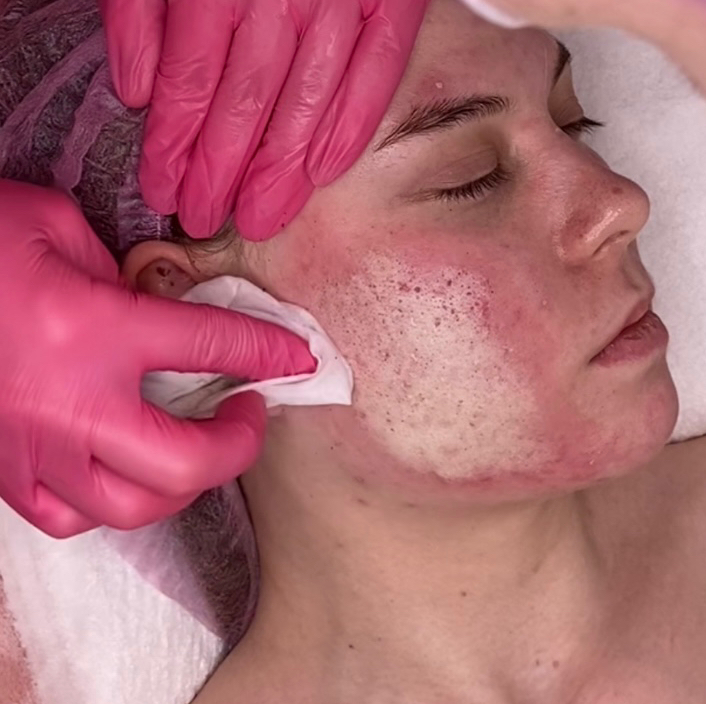 Химическая шлифовка с Бадягой