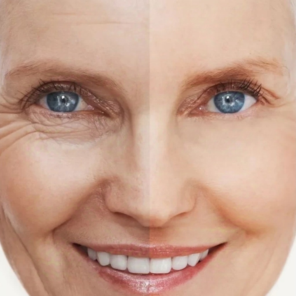 ФОТООМОЛОЖЕНИЕ