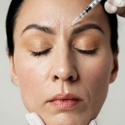 Ботокс ( 1ед - 350р)