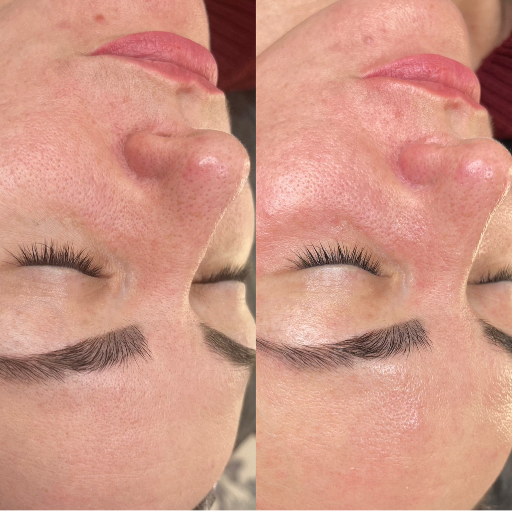 Генеральная чистка +пилинг