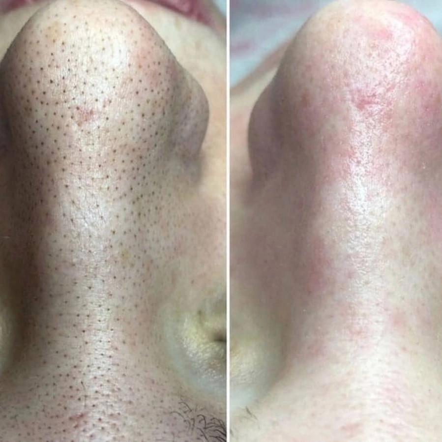 уз чиска лица