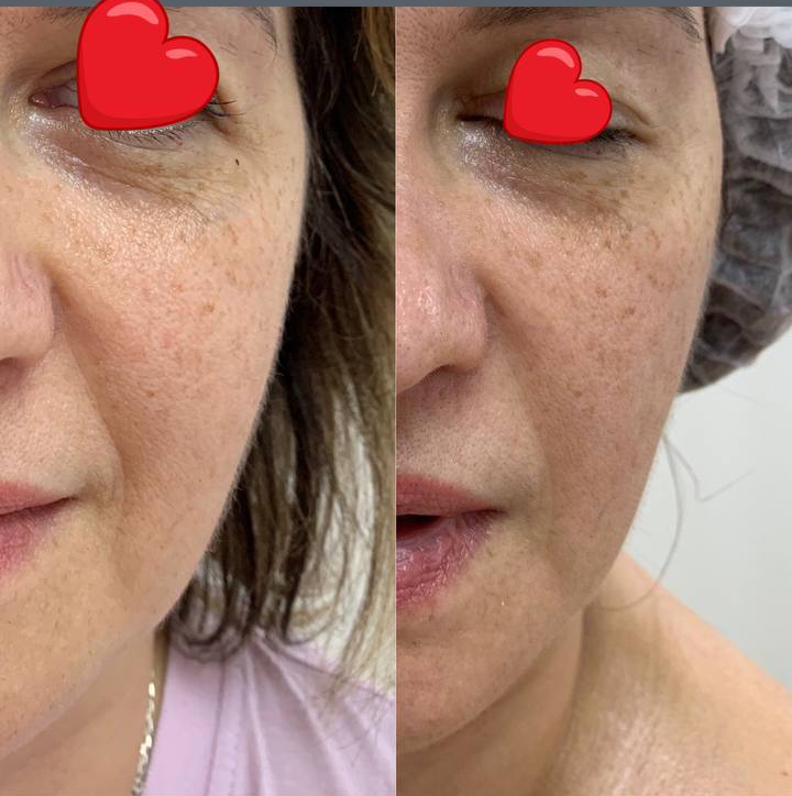 ОМОЛОЖЕНИЕ ЛИЦА