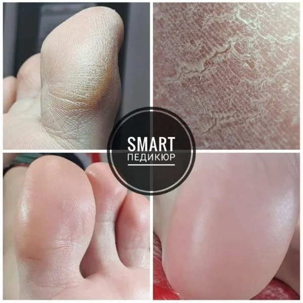 Полный педикюр без покрытия