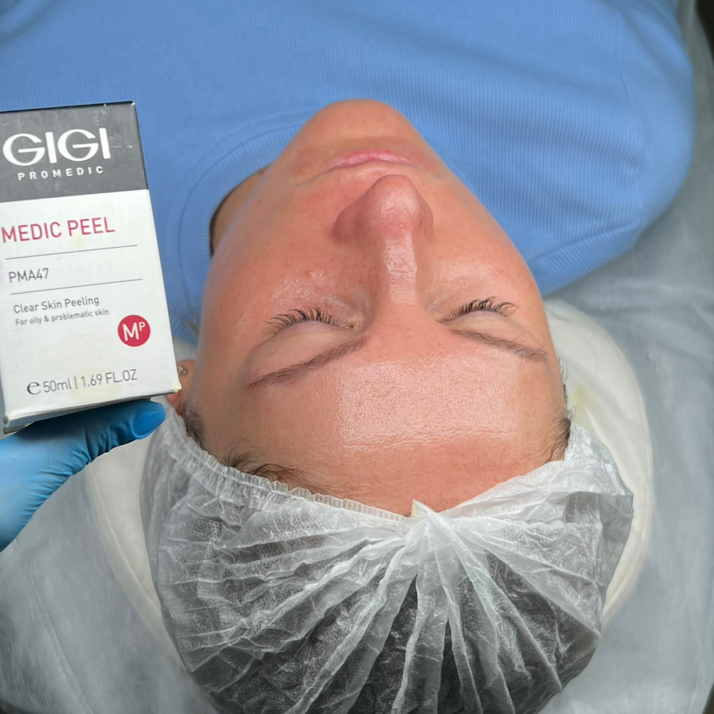 Преображение и обновление с GiGi PMA 47 - CLEAR SKIN PEELING  Для проблемной кожи
