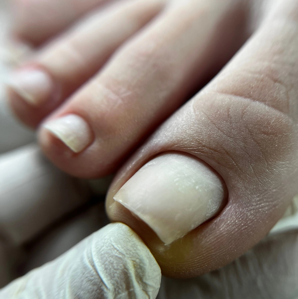 Аппаратный педикюр без покрытия