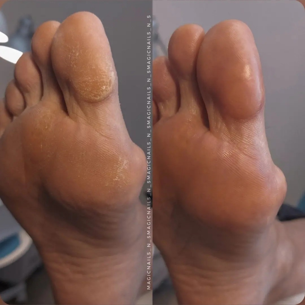 педикюр без покрытия