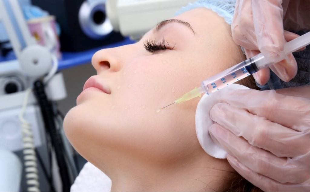 Мезотерапия лица
