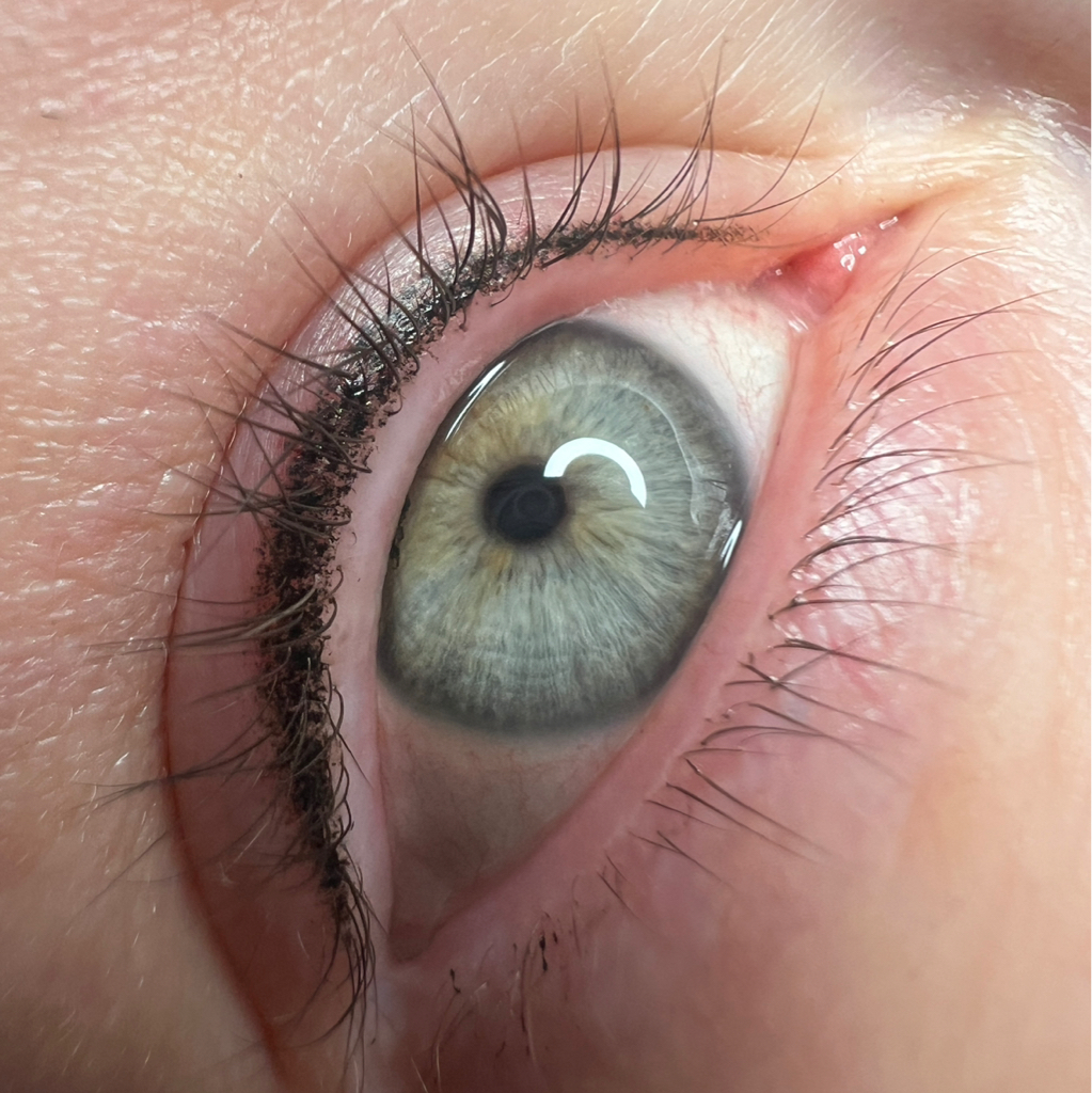 ПМ межресн.(рефреш)
обновление цвета