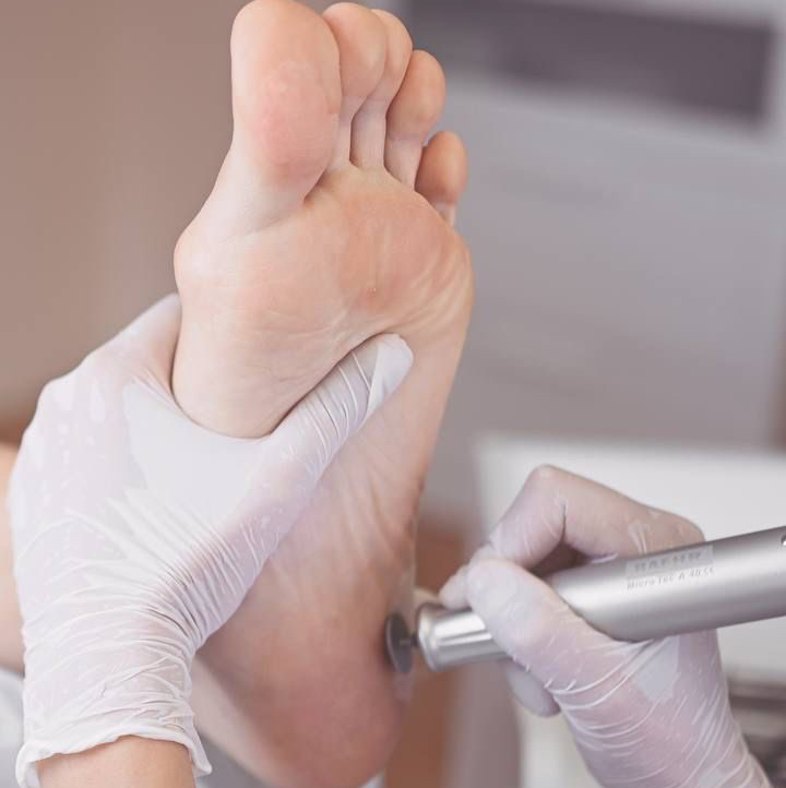 Аппаратный педикюр