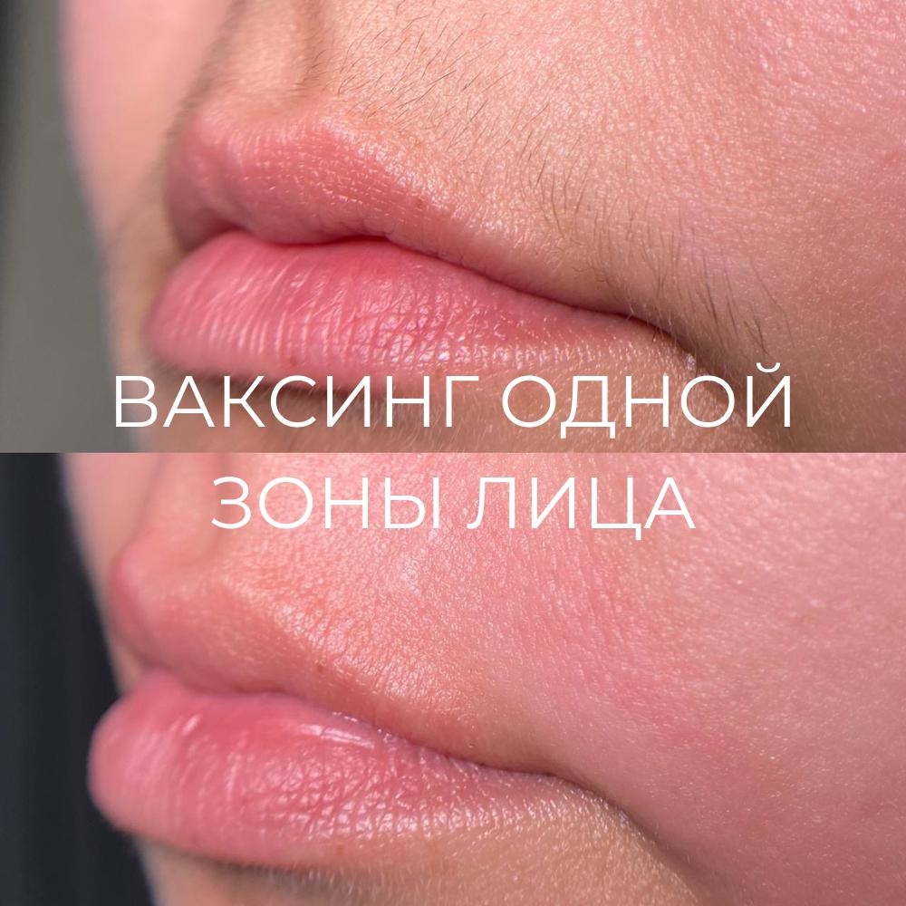 Ваксинг (депиляция) одной зоны лица