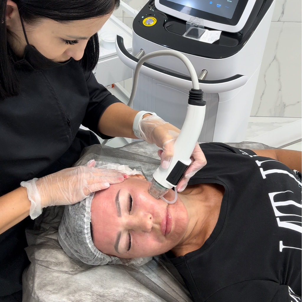 Микроигольчатый RF-лифтинг