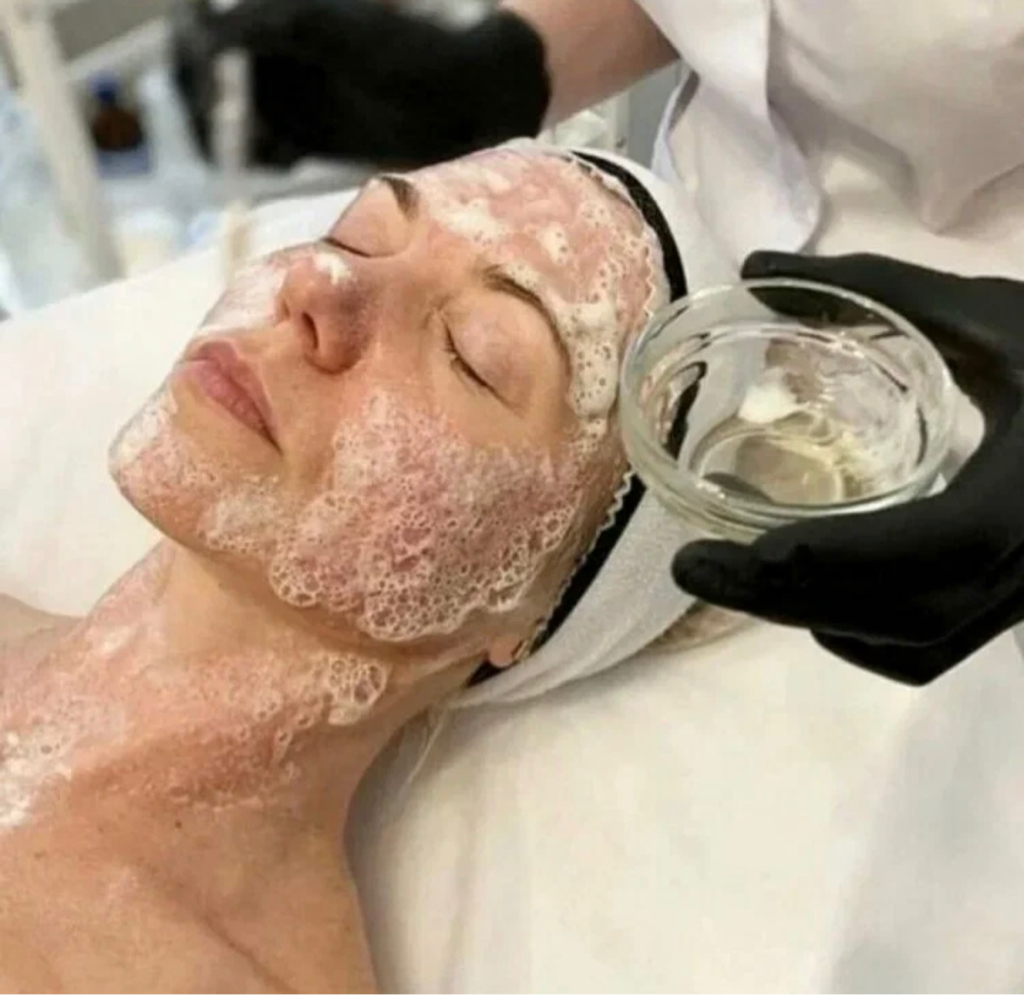 Карбокситерапия