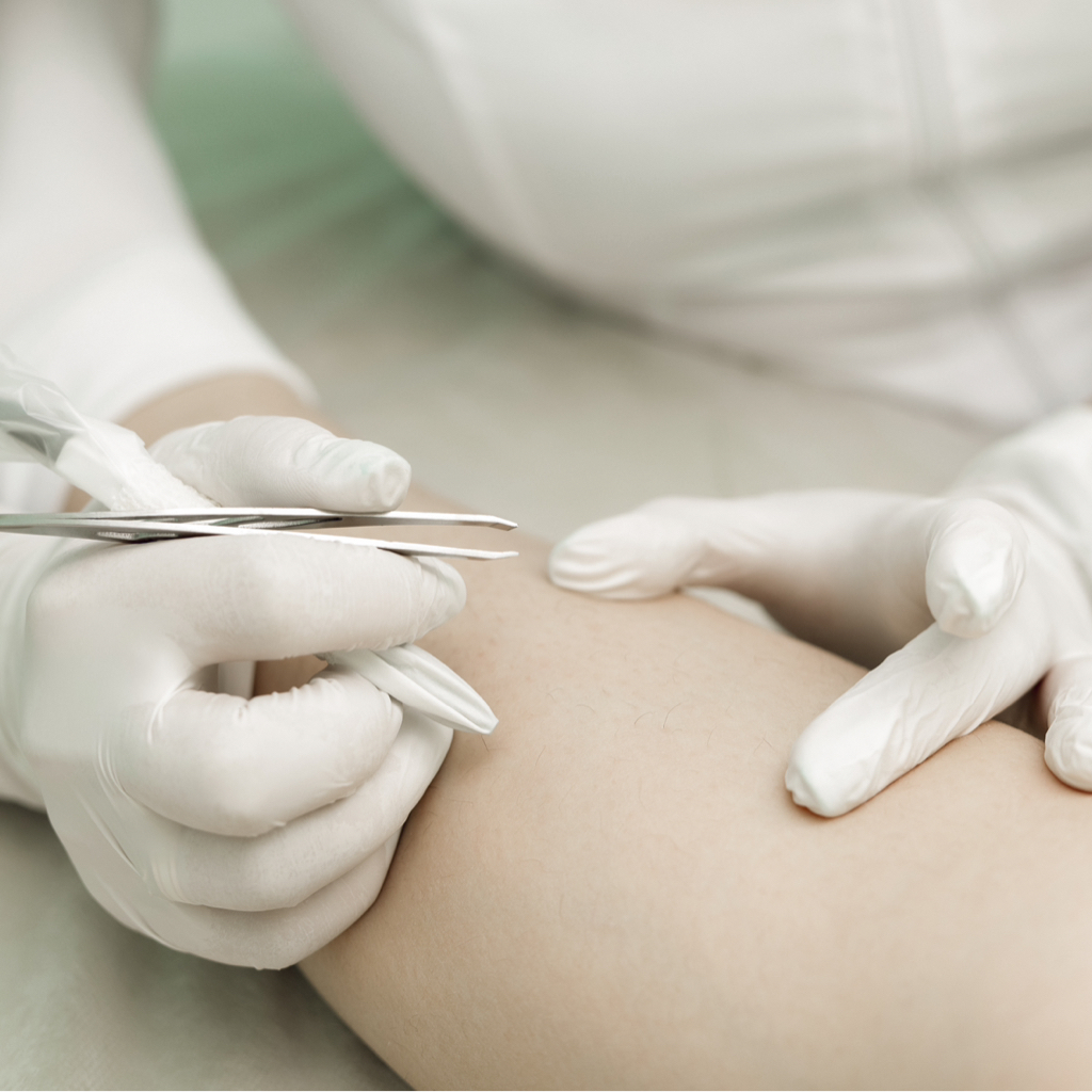 Электроэпиляция 2 часа