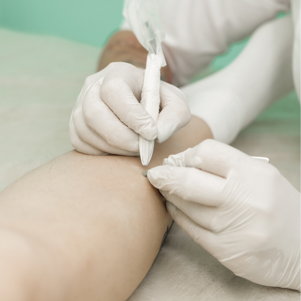 Электроэпиляция 3 часа