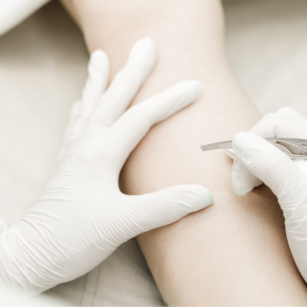 Электроэпиляция 1 час