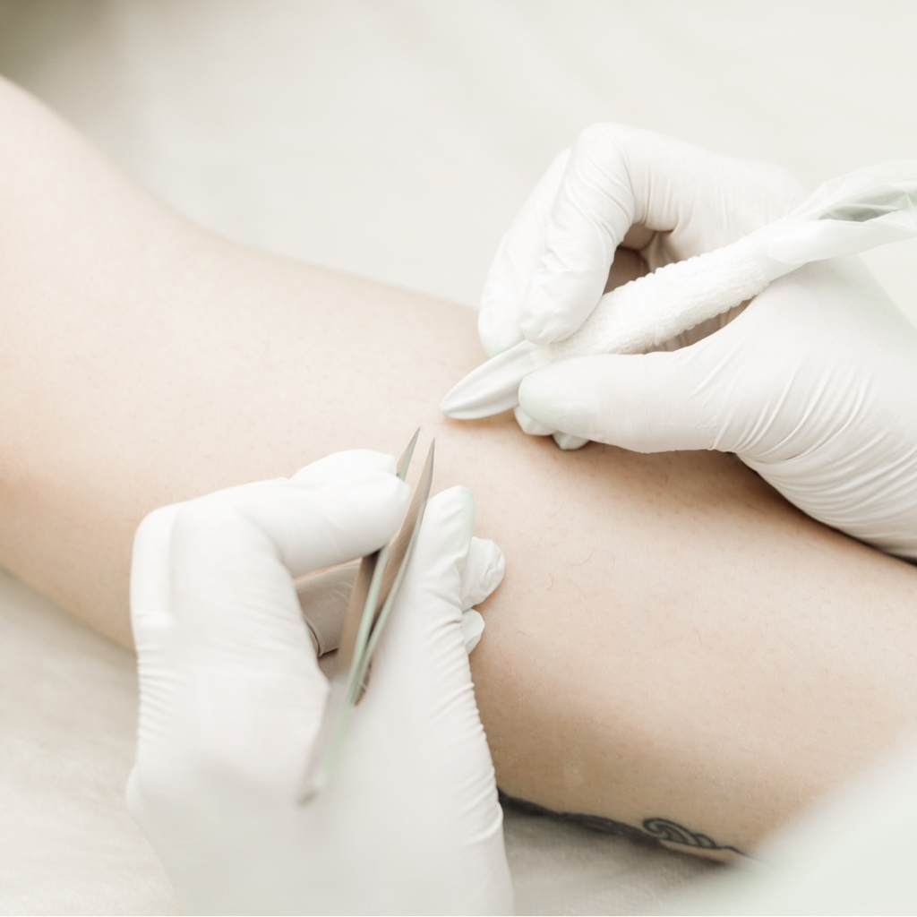 Электроэпиляция 30 минут