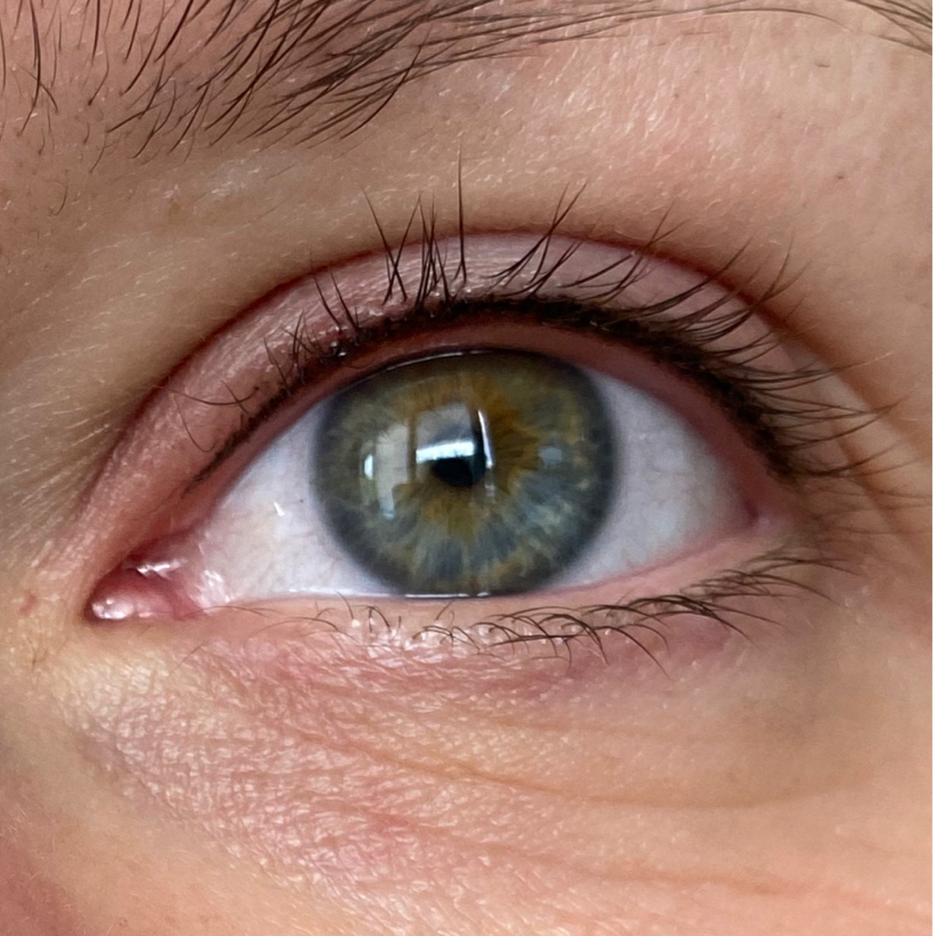 Рефреш межреснички