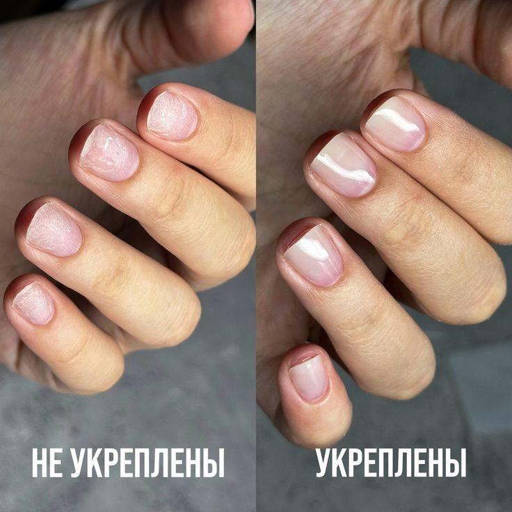 Укрепление Акригелем