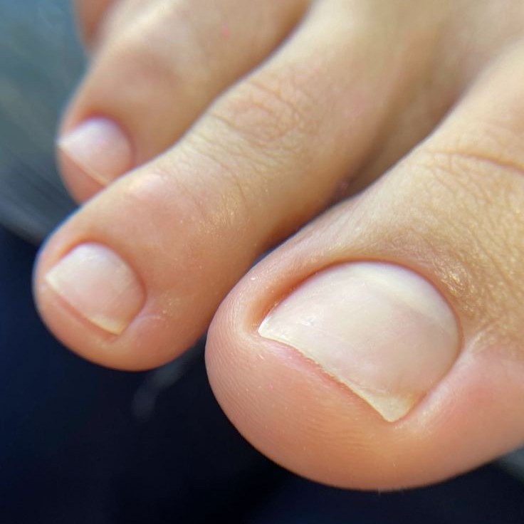 Педикюр обработка пальчиков БЕЗ покрытия