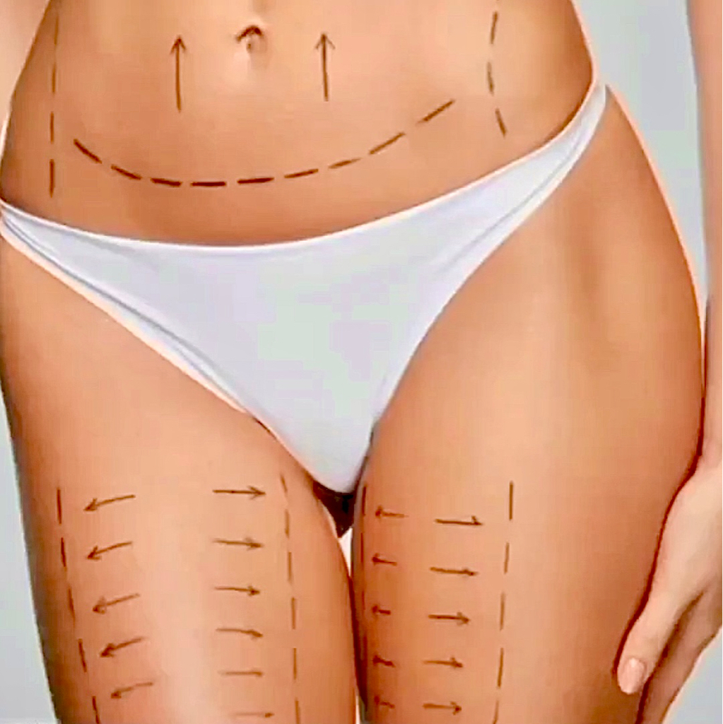 BODY PROGRAMM   8 sessions  , (Solarium  Free ),Σημείο Πείνας δώρο !