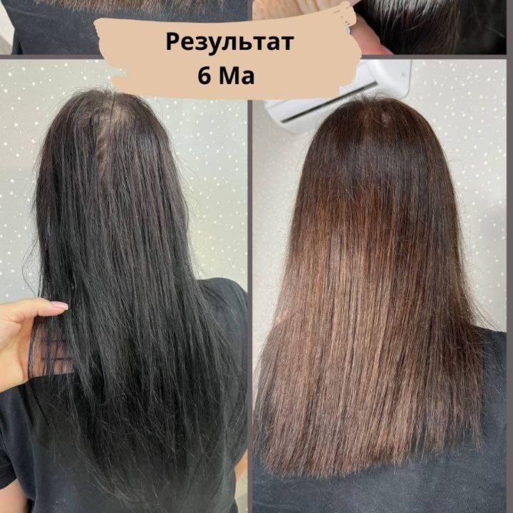 Модели "Выход из темного"