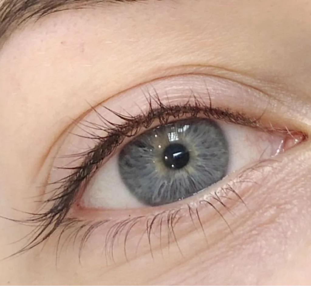 Межресничка