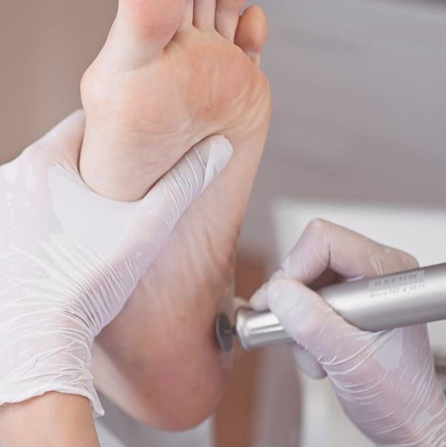 Smart без покрытия