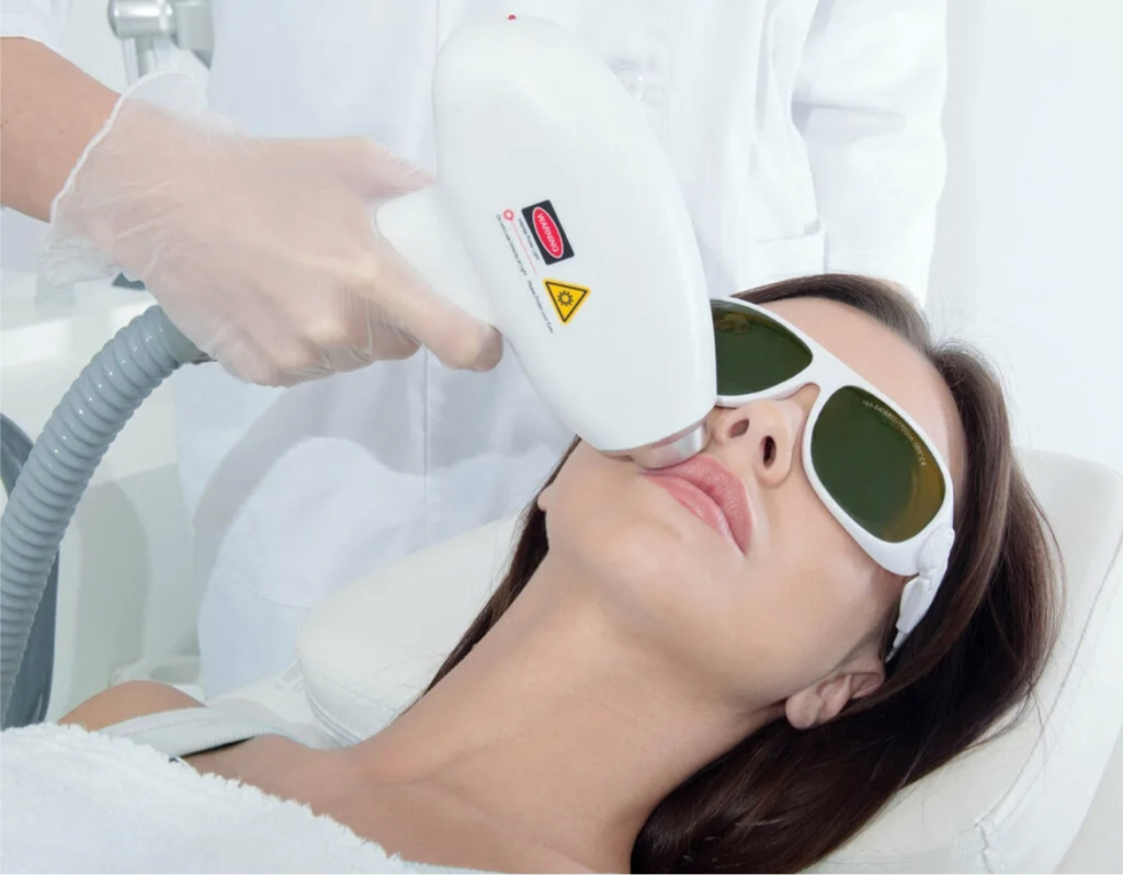 Эпиляция Женщины  
(Зона над верхней губой)