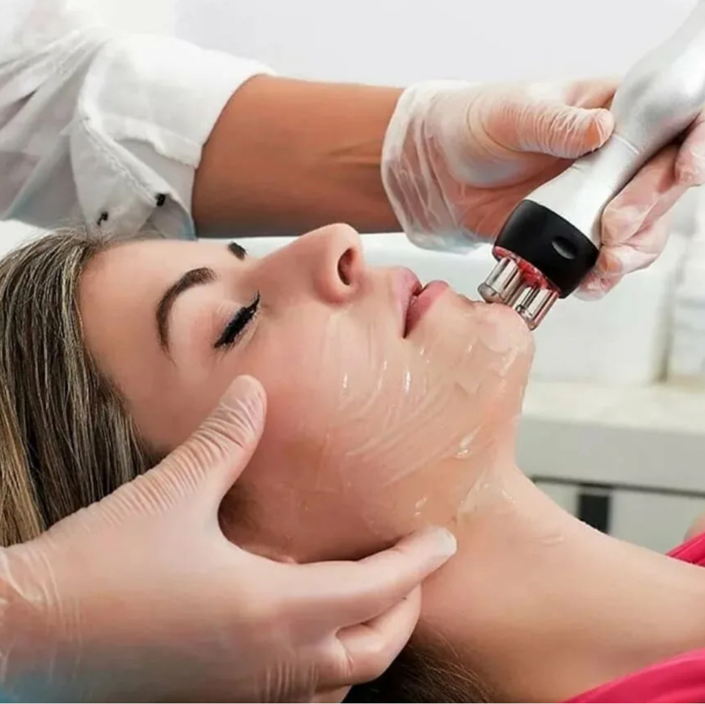 Rf лифтинг (Лицо+шея)