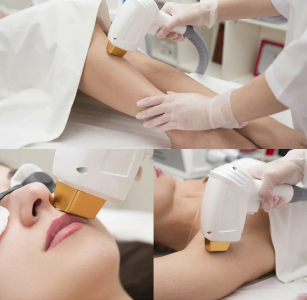 Эпиляция
Женщины
Зоны
(подбородок, бакенбарды, щеки, ареолы, линия живота)
Цена за одну зону