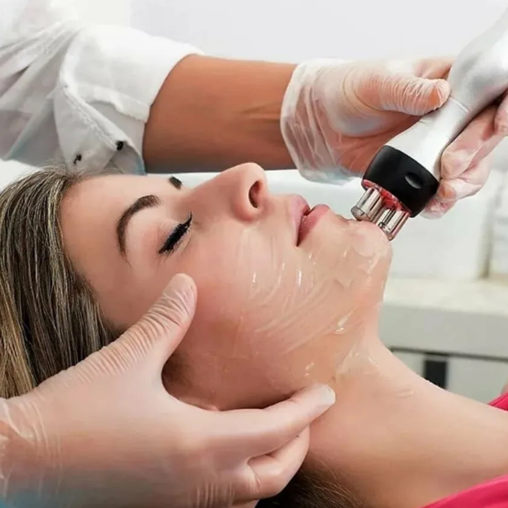 Rf лифтинг (Лицо+шея+декольте)