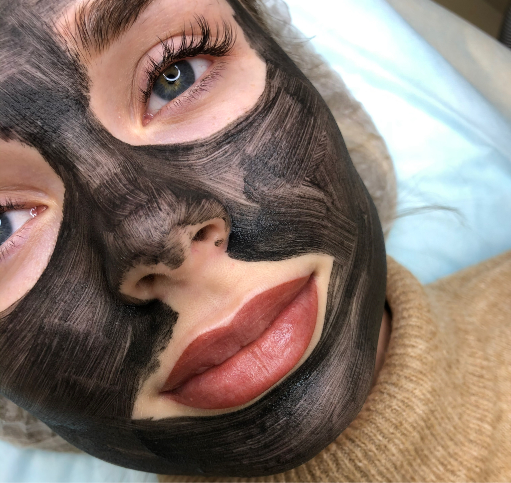 Лазерный карбоновый пилинг