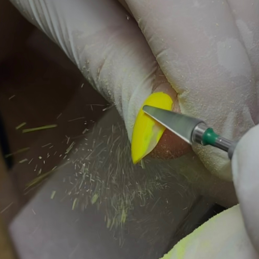 Снятие жёсткого материала/наращенных без последующего покрытия