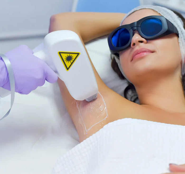 Лазерная Эпиляция Женщины: Подмышечные впадины