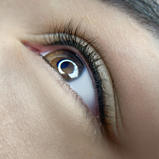 Межресничка