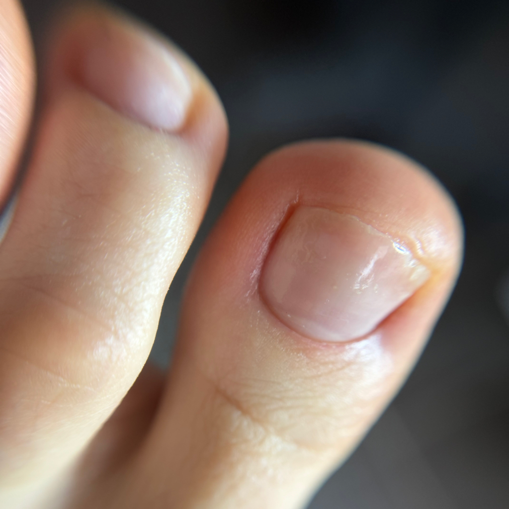 Экспресс педикюр