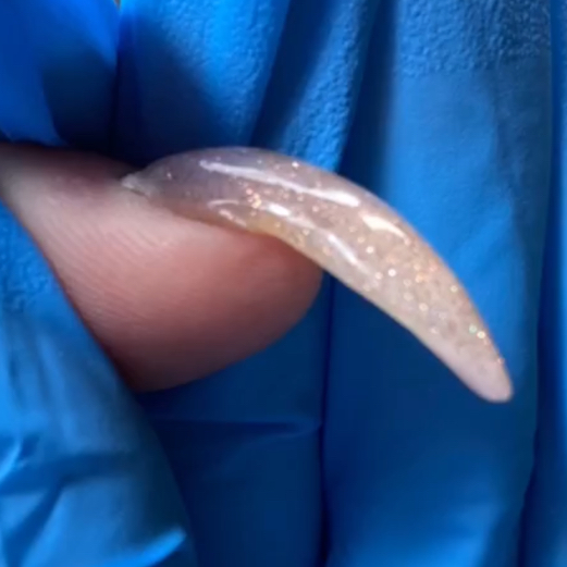 Поднятие клюющего ногтя (за 1 ноготь)