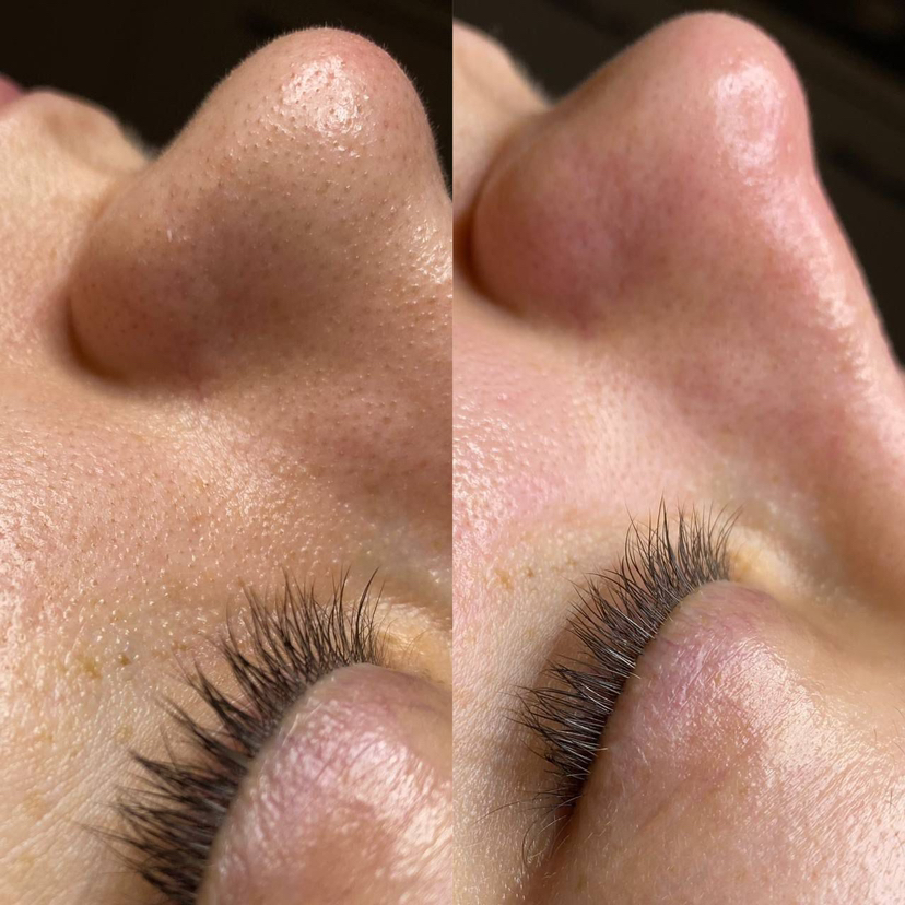 Комбинированная чистка