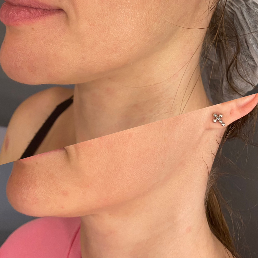 Массаж лица СКУЛЬПТУРНО-БУККАЛЬНЫЙ «Спа-Ритуал»