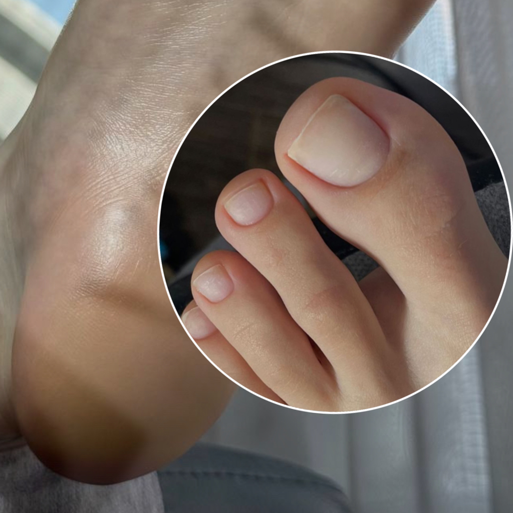 Гигиенический педикюр