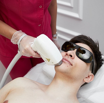 Эпиляция Мужчины Щеки+Над губой (скулы+бакенбарды+усы)